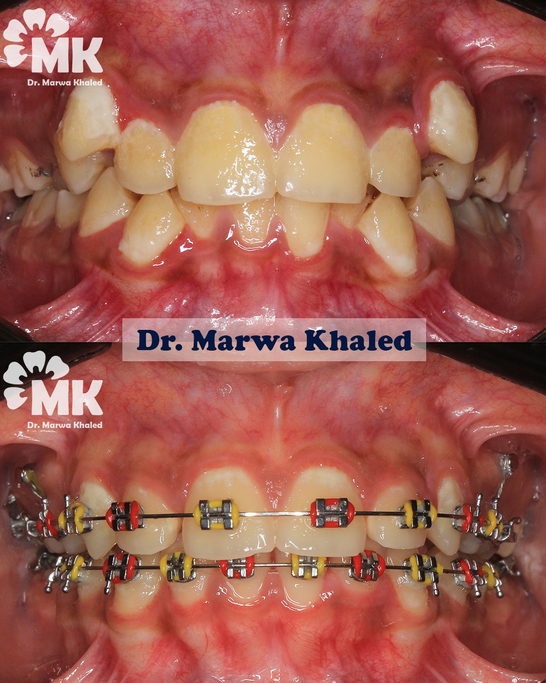 Dr. Marwa Khaled — تقويم الأسنان