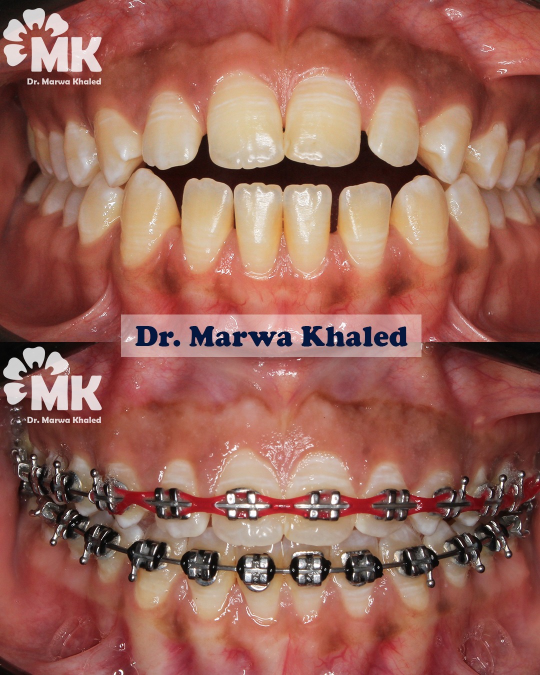 Dr. Marwa Khaled — علاج الفراغات