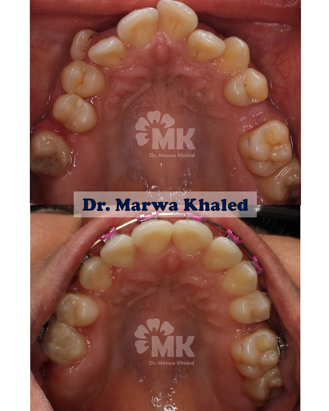 Dr. Marwa Khaled — علاج بالتقويم