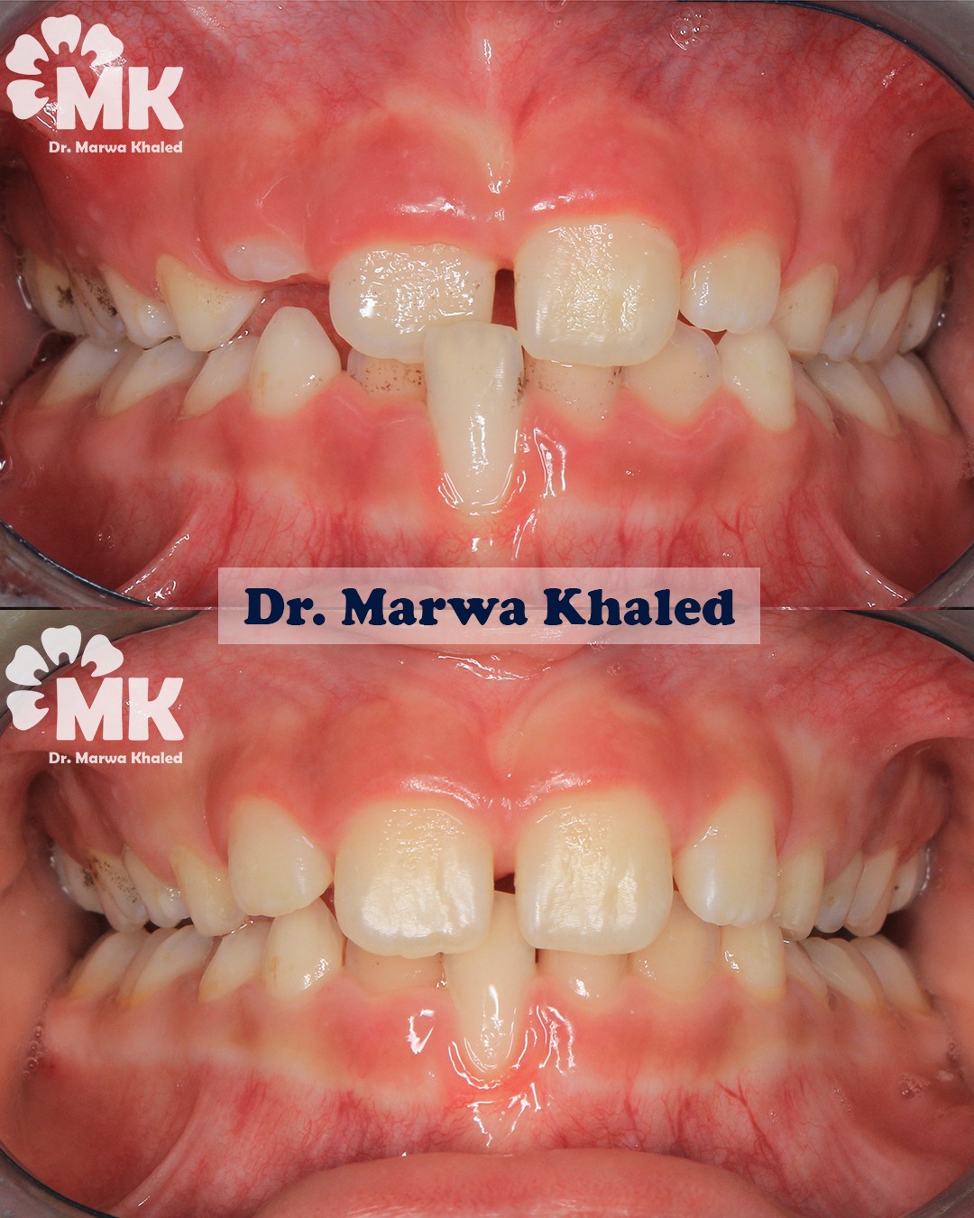 Dr. Dina Khaled — ترميم تجميلي